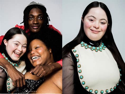 modella gucci sindrome di down|Chi è Ellie Goldstein, la modella di Gucci con la sindrome di Down.